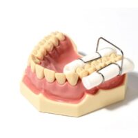 ZT-DENTAL Metal cotton roll holder (1pc)